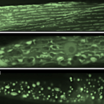 C elegans muscle gfp